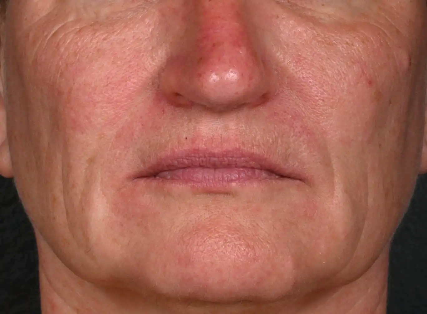 Apres-un-air-triste-relachement-dr-barry