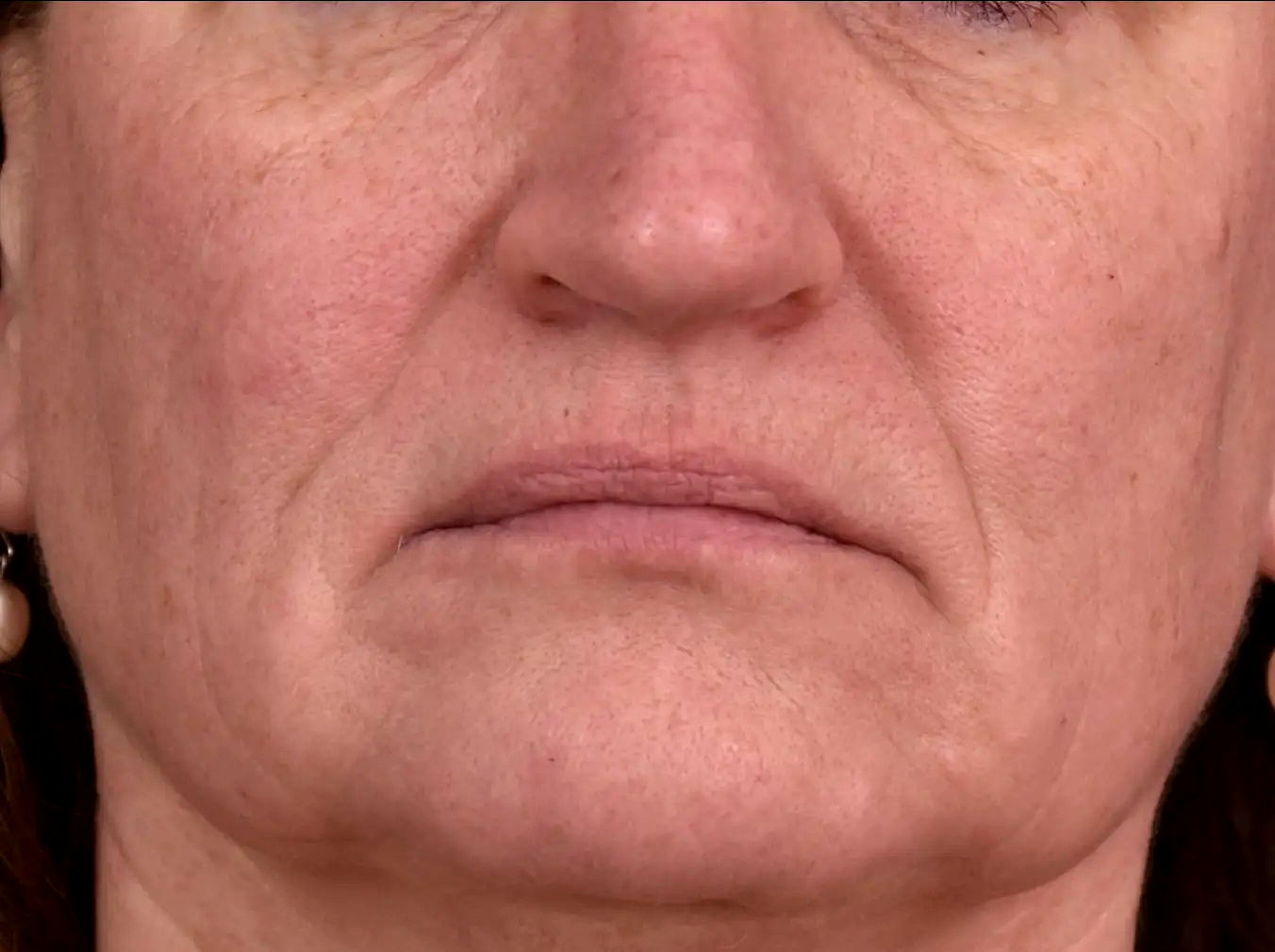 Avant-un-air-triste-relachement-dr-barry