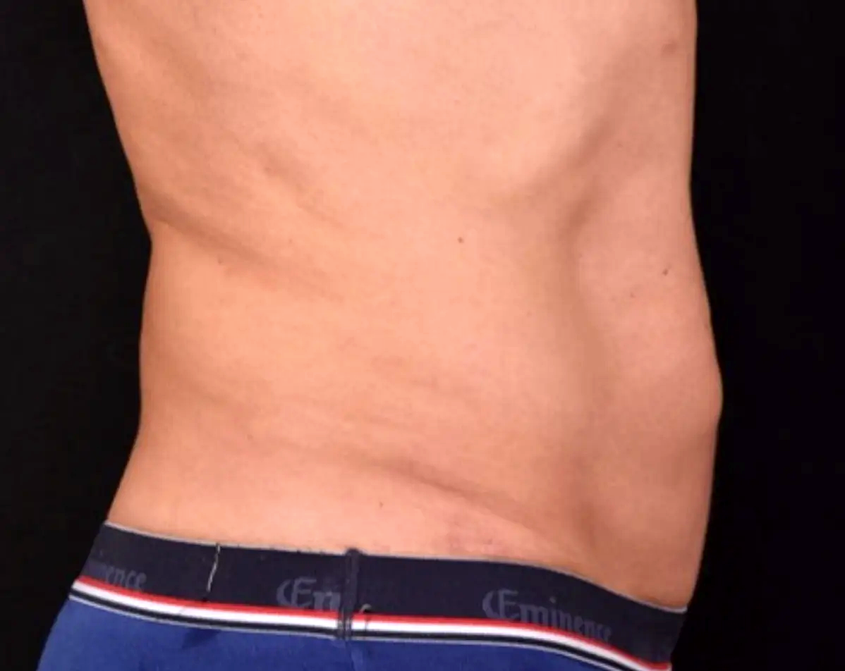 Resistance-malgre-le-sport-apres-dr-barry