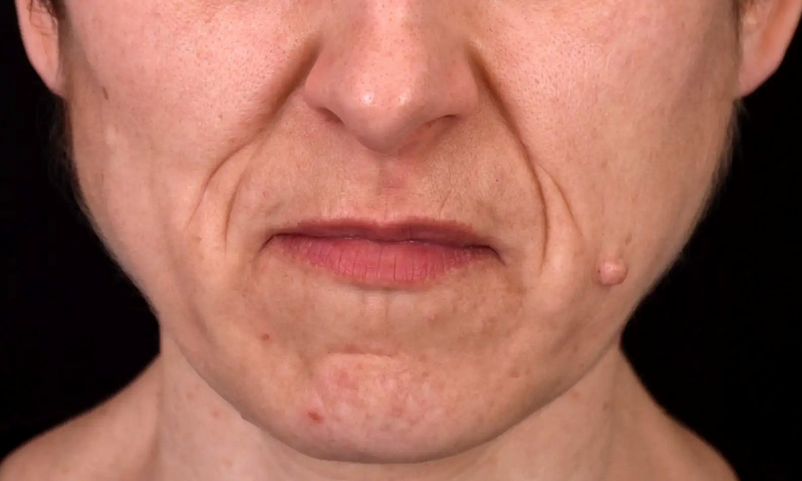 bouche-un-air-severe-avant-dr-barry