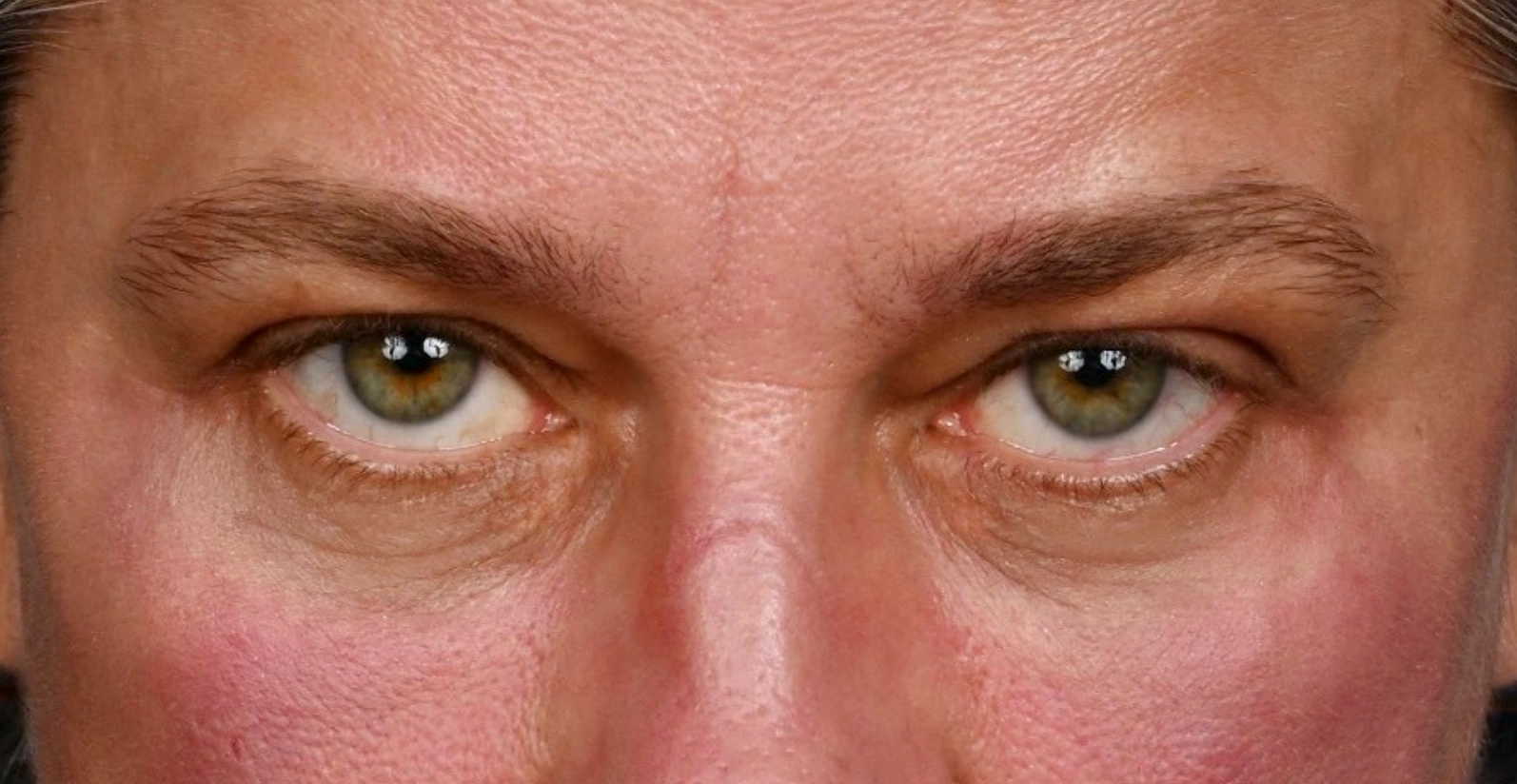 regard-severe-apres-dr-barry