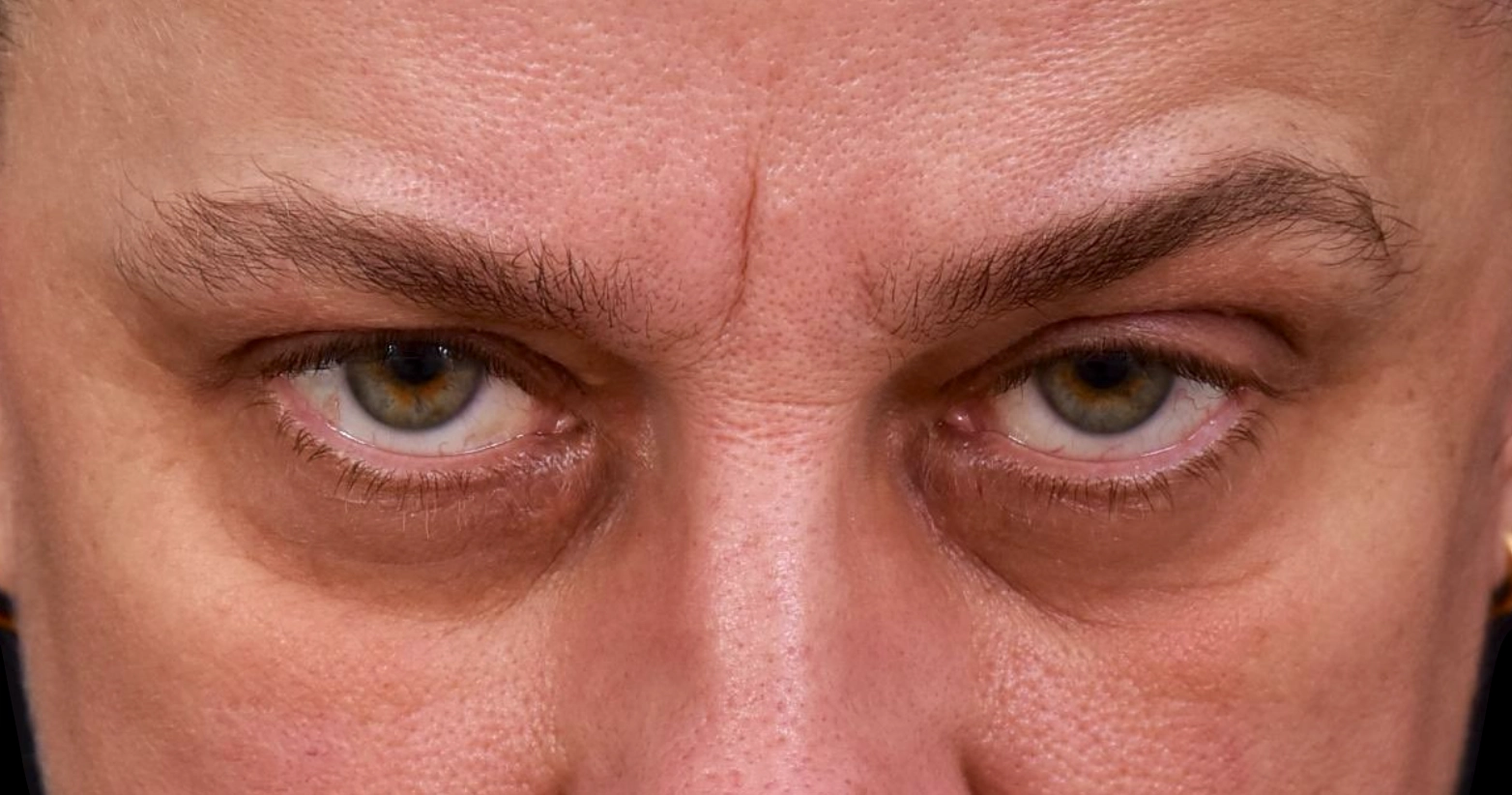 regard-severe-avant-dr-barry