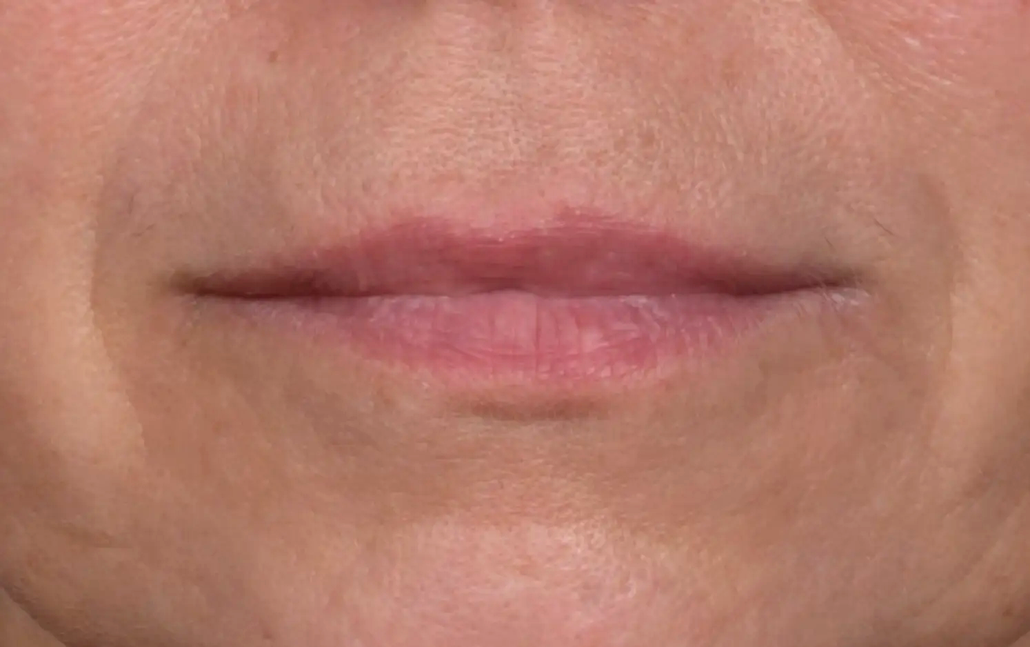 rehydratation-levres-apres-dr-barry