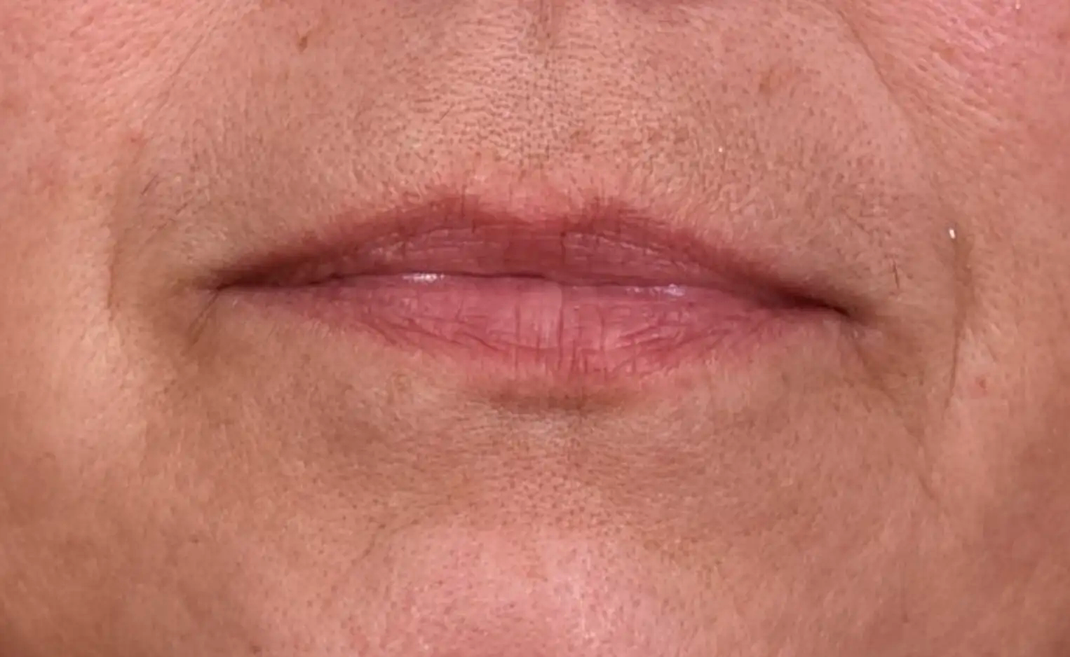 rehydratation-levres-avant-dr-barry